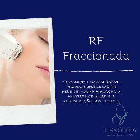RF Fraccionada