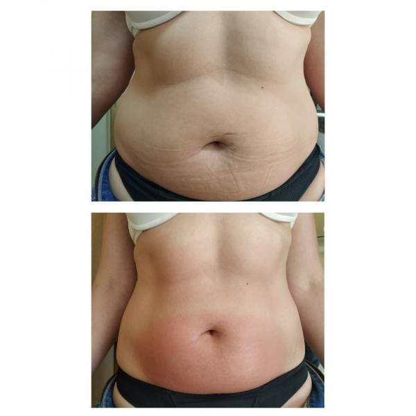 SERVIÇOS DE ESTÉTICA | SAUDE E BEM ESTAR